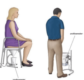 Uroflowmetry – Narayana Medical College